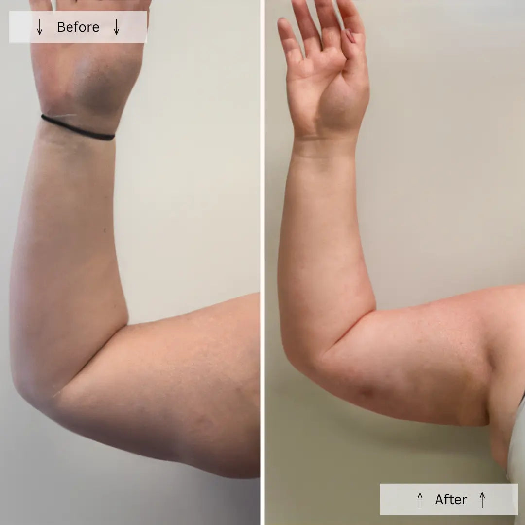 Thera-Cavitat Theratone